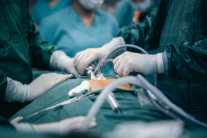 Rinoplastia Ultrassônica