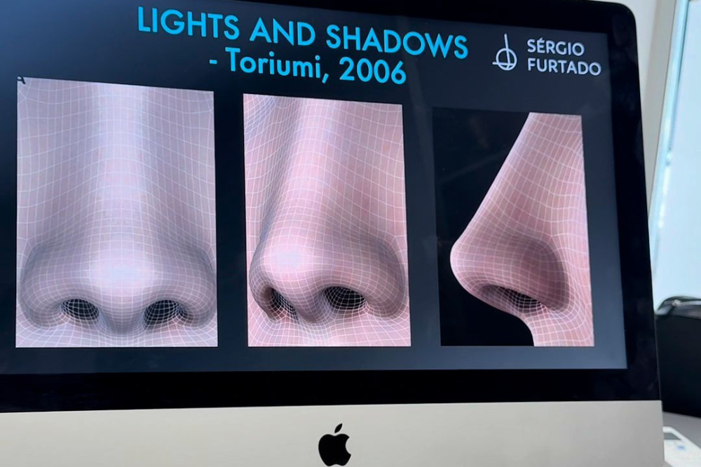 Rinoplastia deixa cicatriz? Entenda as diferenças entre a técnica aberta e a fechada